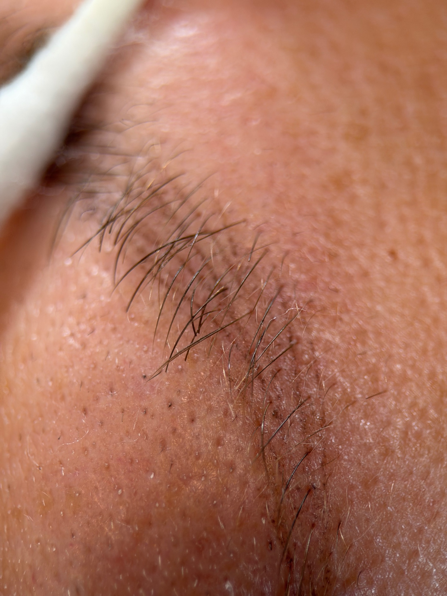Healed nano brow close-up showing fine hairstrokes