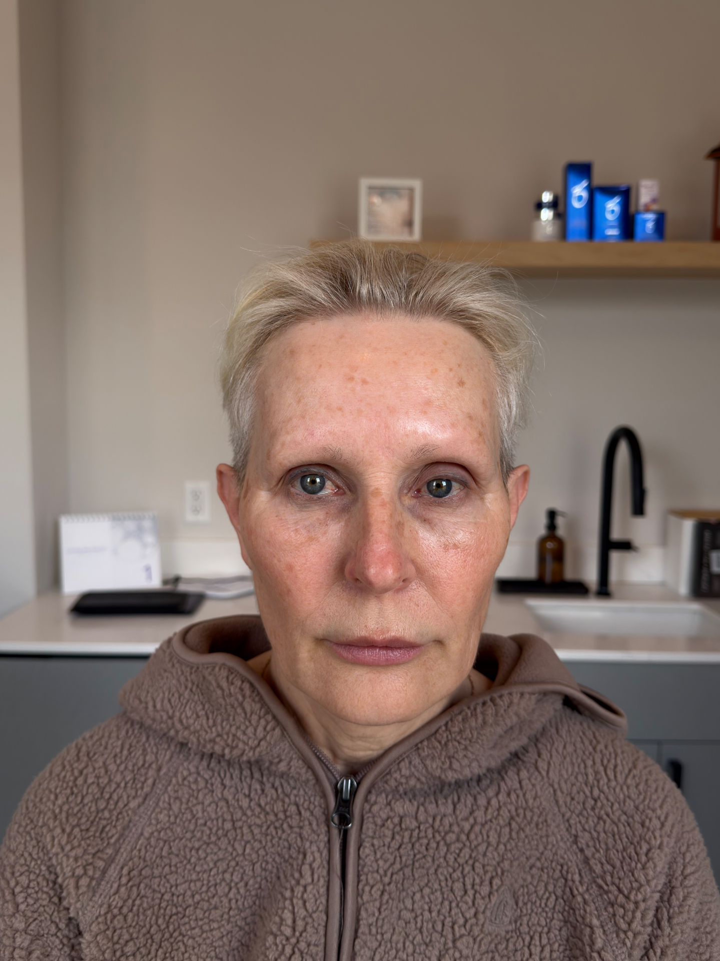 Client before restorative brow tattooing, with significant natural brow loss